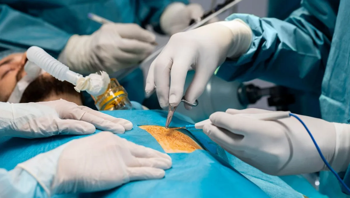 Delhi Woman's 1,500 Gallstones Surgery Success