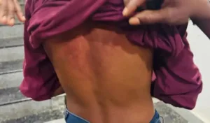 Class 7 Student Beaten at Hyderabad Govt School